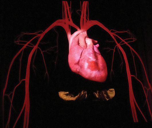 ‘Heart Beat’ by Lisa Roet in the Adelaide Review